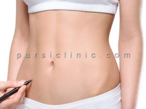 Abdominal and Side Body Shaping